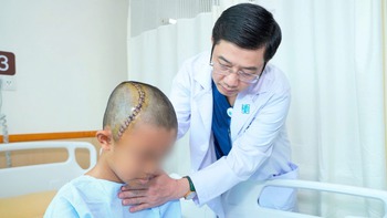 Bác sĩ ở TP.HCM mổ não tỉnh cho cậu bé 12 tuổi, cho làm toán ngay trên bàn mổ