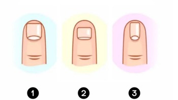 Quiz: Hình dạng móng tay tiết lộ gì con người bạn?
