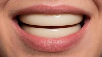 Câu hỏi đang viral: Tại sao con người cần đến 32 chiếc răng?