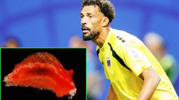 Fan cười ngất khi tên người hùng World Cup được đặt cho sên biển Vozinha
