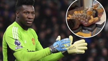 Andre Onana gây rợn người khi 'nâng tầm' liệu pháp giác hơi