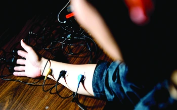 Công nghệ giúp quản lý cơn đau: cơn đau này 'AI' thấu