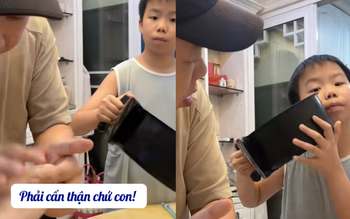 Con trai bắt bài mẹ giả vờ bị phỏng siêu hài hước