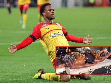 Cầu thủ Juventus gây bão mạng với liệu pháp giác hơi