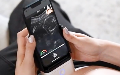 Mỹ phê duyệt thiết bị siêu âm cầm tay của Israel, cho phép thai phụ tự siêu âm tại nhà