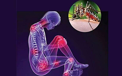 Dịch Chikungunya lan rộng liệu có nguy hiểm?
