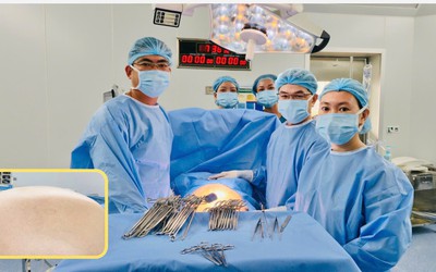 Lấy khối u buồng trứng nặng 20kg - to nhất từ trước đến nay tại Bệnh viện Từ Dũ