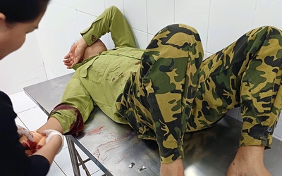 Bắt nghi can chạy trốn, chém thương tích nhân viên bảo vệ rừng Đồng Nai