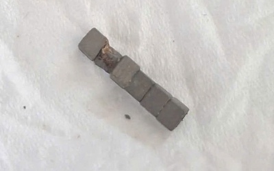 Cấp cứu bé trai nuốt phải nhiều viên nam châm