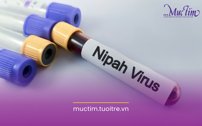 Các biện pháp phòng ngừa virus Nipah