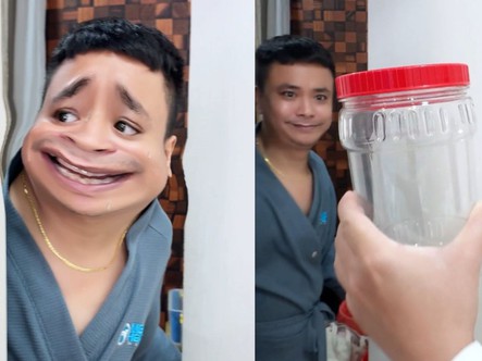 Thanh niên khổ sở vì 'Peter khủng'