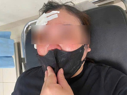 Tài xế bán tải đánh dùi cui vào đầu người đang dừng xe nghe điện thoại