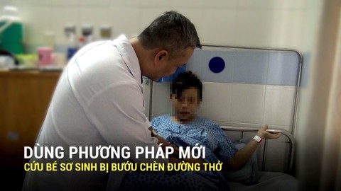 Dùng phương pháp mới cứu bé sơ sinh bị bướu chèn đường thở