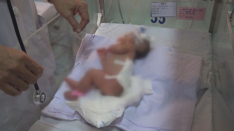 Phẫu thuật khối bướu nặng 3,1kg cho bé sơ sinh 1 ngày tuổi