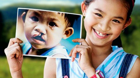 Tin nóng 24h: Tìm lại nụ cười cho trẻ khuyết tật