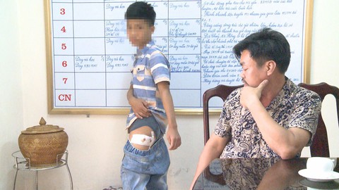 Học sinh lớp 5 mang dao đến trường gây thương tích cho bạn
