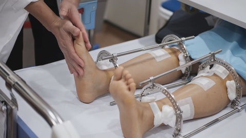 Kéo dài chân, chuyện chưa kể của những người trong cuộc