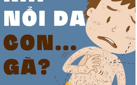 Chữa nổi da gà bằng cách nào?