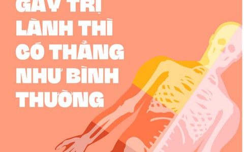 Xương gãy trị lành thì có thẳng như bình thường?