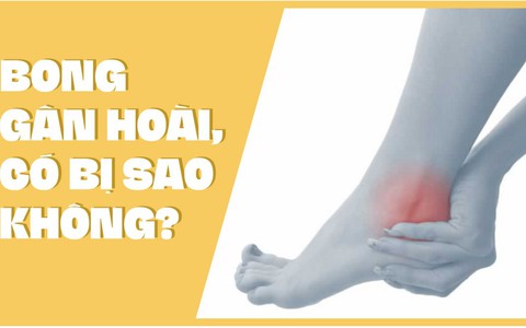 Bong gân hoài, có bị sao không?