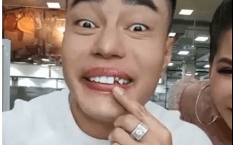 Đang livetream quảng cáo thức ăn, Lê Dương Bảo Lâm rớt răng sứ