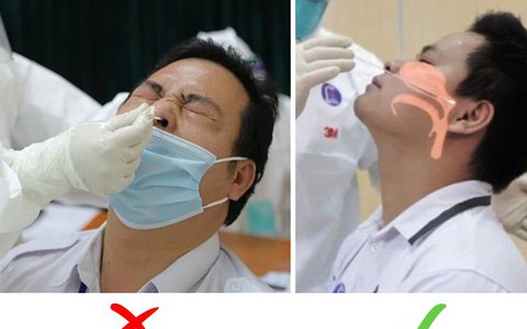Học ngay kinh nghiệm 'thương đau' từ netizen đã xét nghiệm COVID-19
