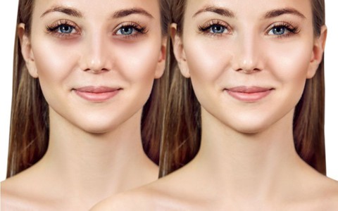 Xử lý ra sao với đôi mắt 'gấu trúc' đầy quầng thâm?