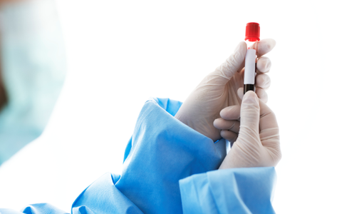 Xét nghiệm kháng thể sau tiêm vaccine, có cần thiết?