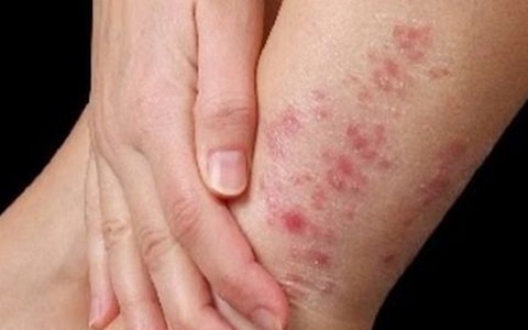 Muôn chuyện về chàm...