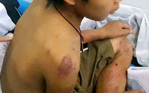 Đề nghị cách ly con trai hay bị cha đánh lúc 'trái gió trở trời'