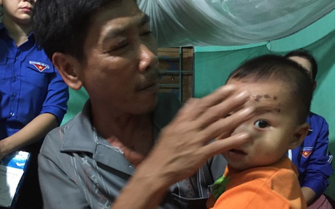Nhân chứng lở núi kể chuyện bé 16 tháng tuổi sống sót kì diệu