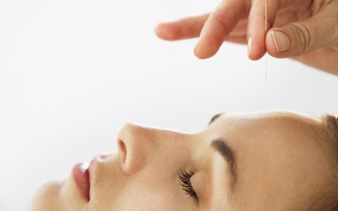 Thận trọng với bệnh liệt dây thần kinh số 7 ngoại biên