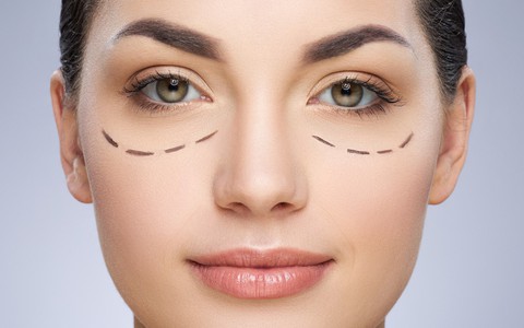 Cắt mí mắt, đừng để xấu vì thiếu hiểu biết