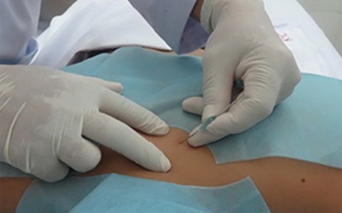 Dân văn phòng dễ bị hội chứng cổ vai