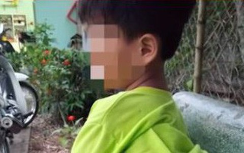 Bộ GD-ĐT yêu cầu xác minh học sinh lớp 1 bị cô giáo đánh bầm tím