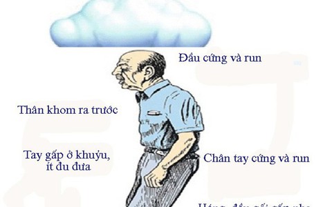 Ngăn chặn tàn tật do bệnh Parkinson