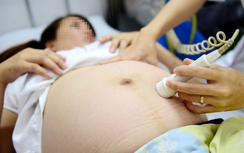 Thai nhi hơn 10 tuần tuổi mắc hội chứng Down, làm sao?