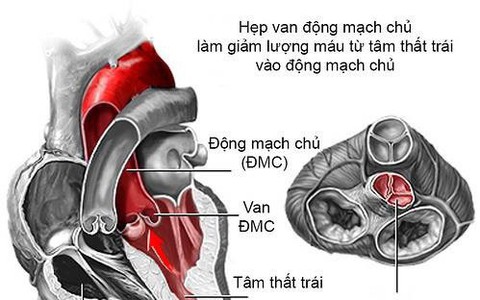 Bộ Y tế bỏ dự định khám sinh dục trong tiêu chuẩn sức khỏe lái tàu