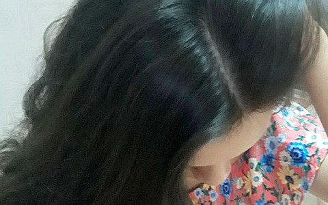 Tóc phản ánh sức khỏe