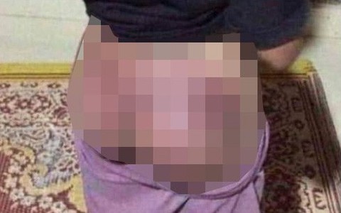 Công an viên thừa nhận còng tay, dùng gậy đánh bé gái thiểu năng