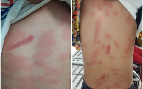 Khởi tố cô ruột vì đánh cháu thương tích 13 %