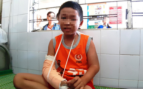 Truy tìm kẻ nhẫn tâm cướp tiền, đánh đập gãy tay cậu bé bán vé số