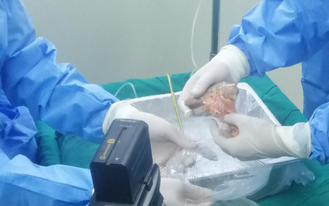 Bệnh viện Đa khoa Thanh Hóa ghép thận thành công từ người chết não