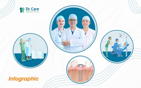 Toàn cảnh ca trồng răng Implant không đau tại nha khoa chuyên sâu