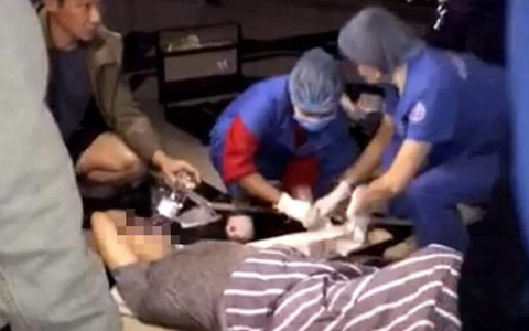 Bước ra từ thang máy chung cư, người đàn ông hụt chân rơi luôn xuống sảnh
