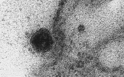 Lần đầu ghi được khoảnh khắc virus corona tấn công tế bào