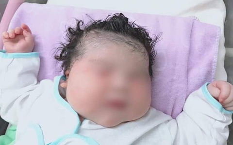 Một bé gái ở Sóc Trăng chào đời với cân nặng 6,1kg
