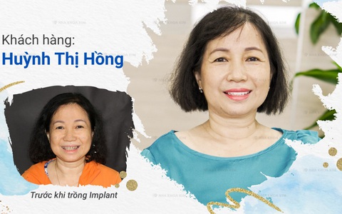 Trồng Implant khôi phục răng vĩnh viễn, tự tin tận hưởng cuộc sống