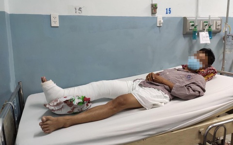 Vụ ôtô húc loạt xe máy: nạn nhân bị giập phổi, chấn thương thận, ngực