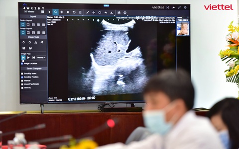1.800 ca COVID-19 nặng được hội chẩn qua Telehealth